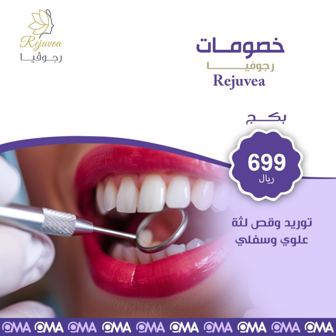 Picture of توريد وقص لثة علوي وسفلي من رجوفيا كلينيك
